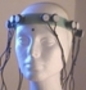 Magnetic Stimulation